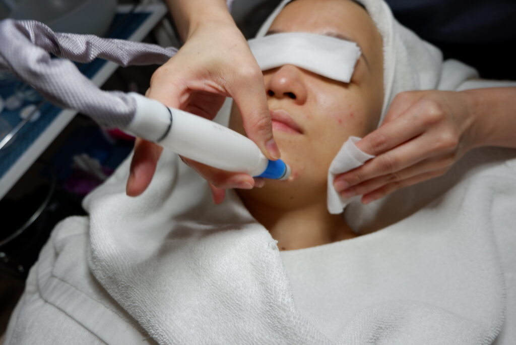 Indulgence Beauty Singapore Facial Extraction 