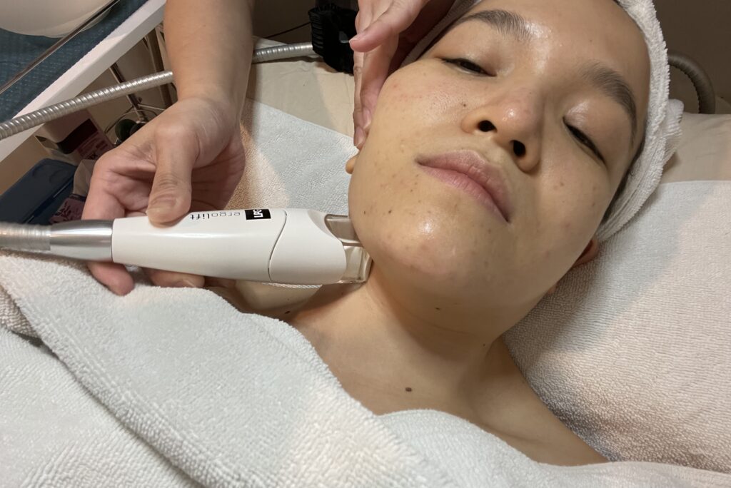 Indulgence Beauty LPG Beauty treatment Facial Extractions 