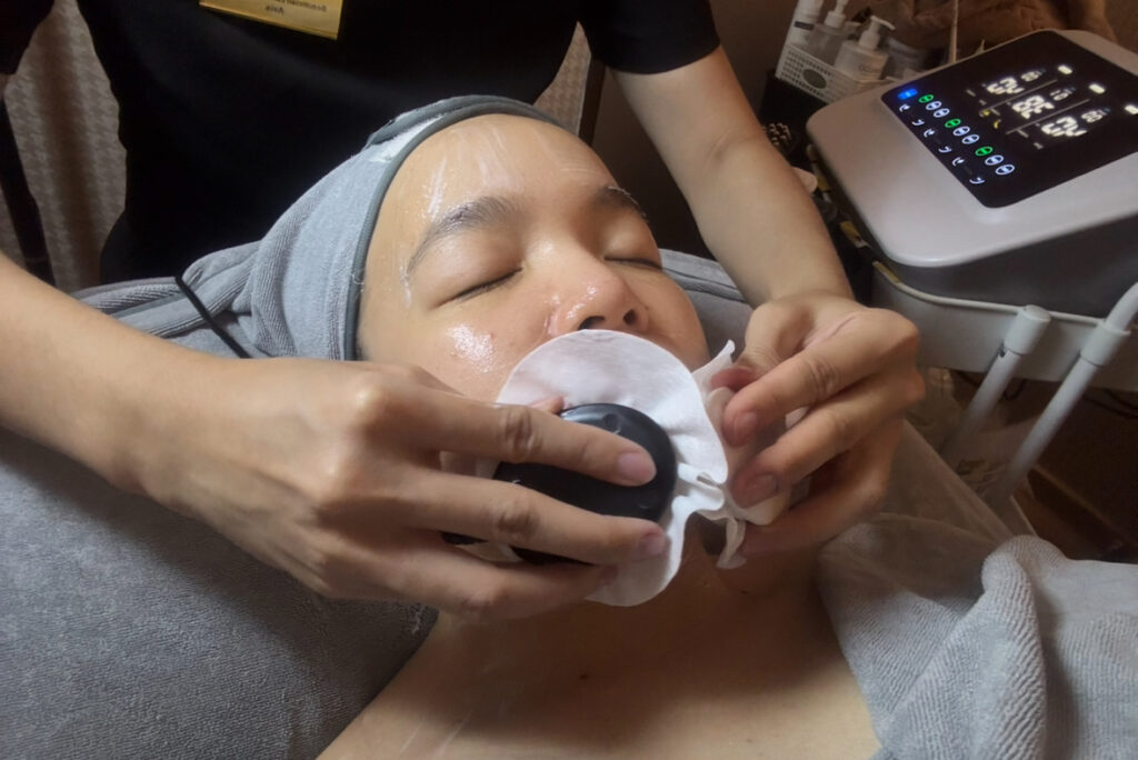 Donna Beauty Ang Mo Kio BES facial treatment